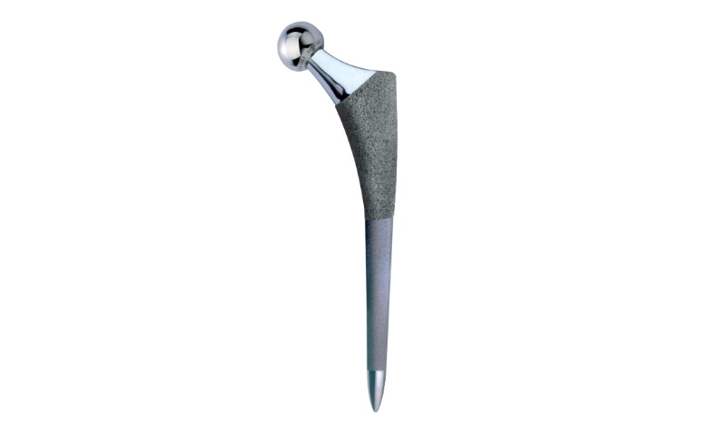 Arthroplasty